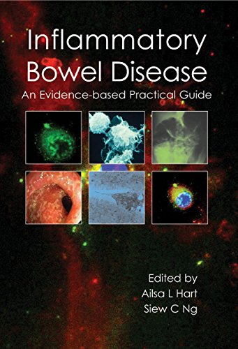 Inflammatory Bowel Disease: an Evidence-based Practical Guide (English Edition)