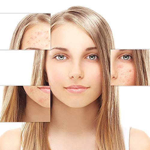 Jabón Natural, Jabón Manos y Cara, Jabón Vegano, Aloe Jabón 100% Natural Lucha Contra el Acné, Limpia, Purifica e Hidrata Profundamente la Piel