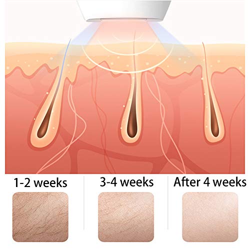 JI TA Dispositivo De Depilación Ipl, Utilizado Para 600,000 Pulsaciones De Depilación, Permanentemente Con Sensores De Piel Para El Hogar Y Los Viajes, Hombres Y Mujeres (rosa, Blan