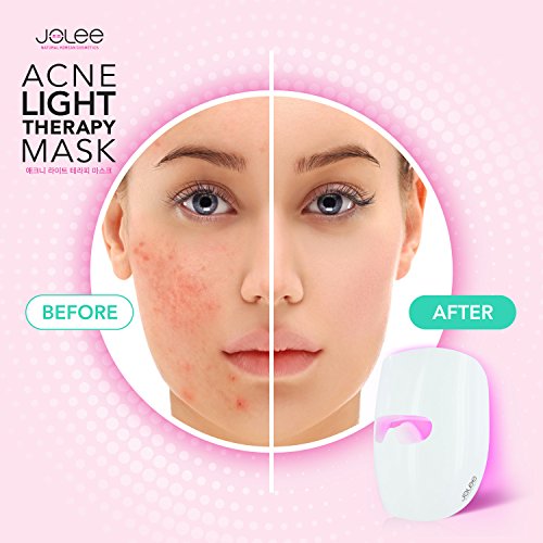 JoLee Máscara de Terapia Ligera Contra el Acne, Dermatológicamente Probada, Reduce el Acné, las Manchas y las Arrugas, Resultados Visibles en 30 Días, Rejuvenecimiento de la Piel. Máscara Antiacné