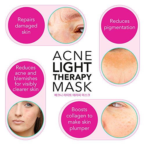 JoLee Máscara de Terapia Ligera Contra el Acne, Dermatológicamente Probada, Reduce el Acné, las Manchas y las Arrugas, Resultados Visibles en 30 Días, Rejuvenecimiento de la Piel. Máscara Antiacné