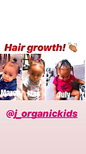 J'Organic Solutions hair growth Scalp stimulator (Hair Grease for Kids) Softer, shinier, healthier hair, with Lanolin, Sweet Almond Oil, Castor Oil & More