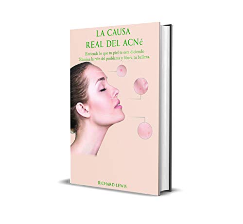 La Causa Real Del Acne: Entiende lo que tu piel te esta diciendo, elimina la raiz del problema y libera tu belleza!