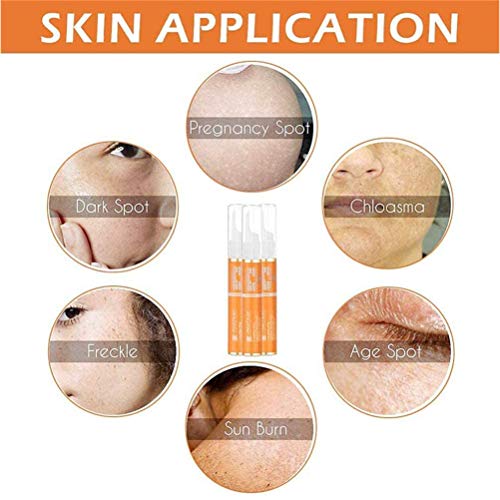 LifeBest 15g Crema blanqueadora Antimanchas VC Eliminación de Manchas de pecas Crema blanqueadora Tratamiento Facial antienvejecimiento para hiperpigmentación