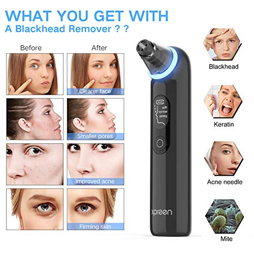 Limpiador de Poros, Xpreen Limpiador Facial Blackhead Remover Eliminador Puntos Negros Electrónico Recargable con Pantalla LED 4 Cabezales y 3 Modos para Espinillas y Acné (Negro 01)
