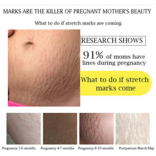 Lucoss Crema Corporal Anti Estrías,Crema Reafirmante Post-parto Reductor Cicatrices Estrías en Embarazo,Corrección Estrías Crema Reafirmante