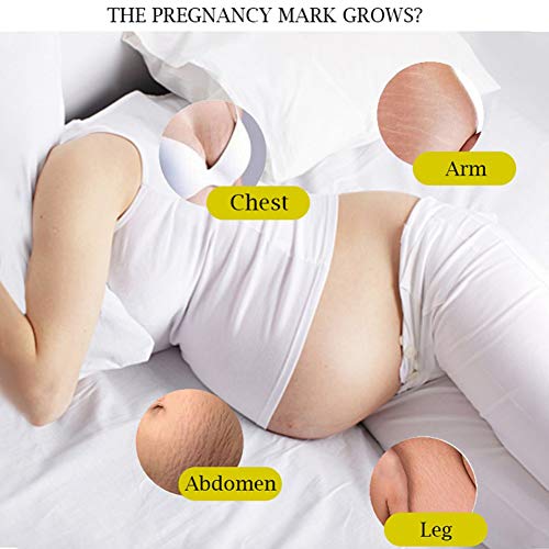 Lucoss Crema Corporal Anti Estrías,Crema Reafirmante Post-parto Reductor Cicatrices Estrías en Embarazo,Corrección Estrías Crema Reafirmante