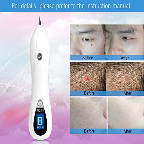 Manchas Cara Eliminación,Spot Mole Ir a tatuaje para salón de belleza en casa(Plata)