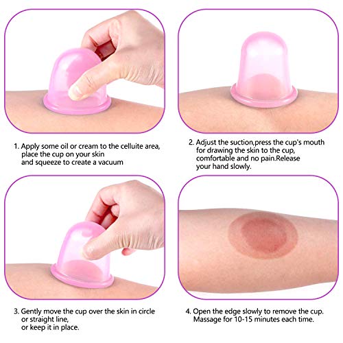 Masajeador Anticelulítico, GuKKK Masaje Anti Celulitis, Celulitis Kit con Anticelulitis Ventosas Cupping Cup Rodillos taza de Masaje, para piel Anticelulítica, Antienvejecimiento y Suave (Rosado)