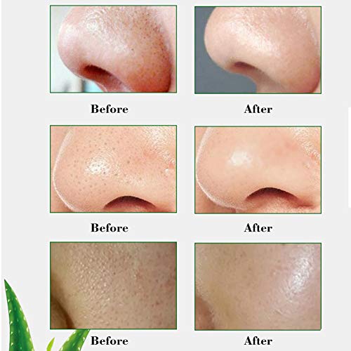 Mascarilla para espinillas, puntos negros, exfoliante de aloe vera, antienvejecimiento, para el acné, 100 g