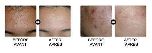 Mizon All in One Snail Repair Cream Tubo 35 ml – Cosméticos, etnia coreana