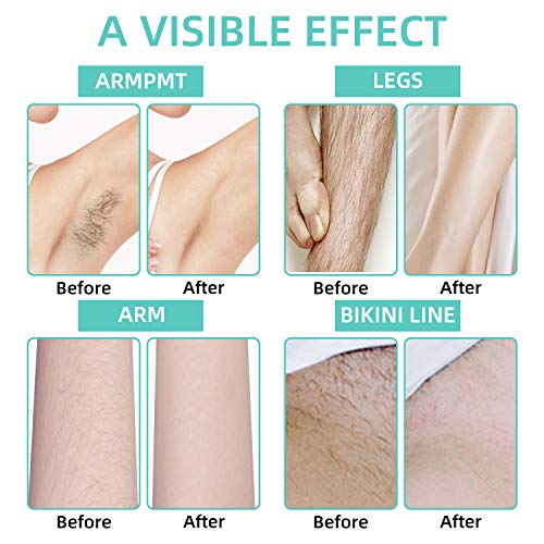 moinkerin 300g Perla de Cera Depilatoria Profesional Cera Caliente Depilacion para Depilación, Depilación con Depilación de Cuerpo Completo