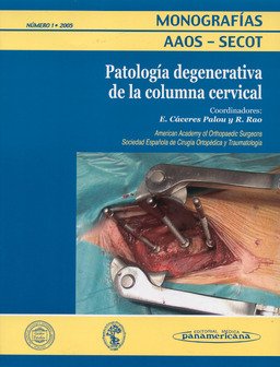 Monografía Nº 1/2005: Patología Degenerativa de la Columna Cervical