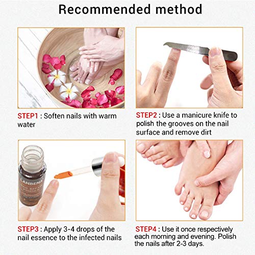 Nail Repair Essence Tratamiento de reparación de uñas Pies Cuidado de las uñas Essence Nail Nourishing Liquid