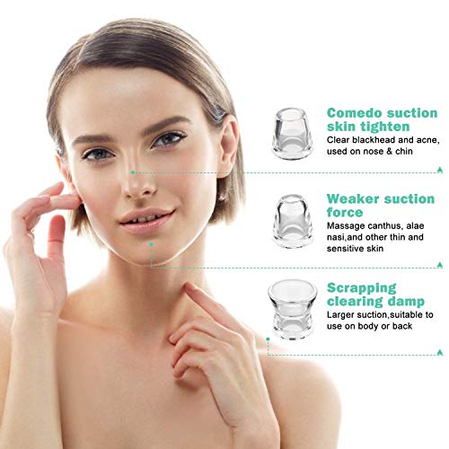 NAVANINO Limpiador de Poros con la luz azul, Combinación de vibración y Caliente Combinar, 4 Sondas Multifuncionales y 3 Niveles de Succión Ajustables para la salud facial y la limpieza