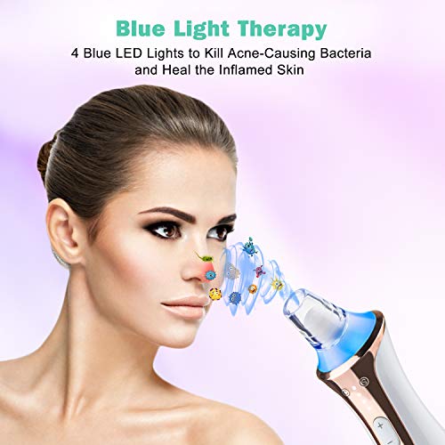 NAVANINO Limpiador de Poros con la luz azul, Combinación de vibración y Caliente Combinar, 4 Sondas Multifuncionales y 3 Niveles de Succión Ajustables para la salud facial y la limpieza
