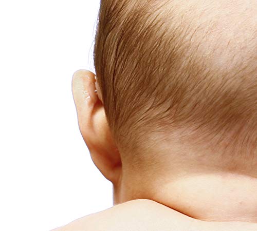 Otostick® Baby kosmetische korrekturteile für abstehende ohren (8 Korrektoren)).