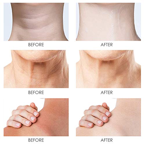 Parche Antiarrugas Cuello,Máscara de Cuello de Colágeno,Máscara para Cuello, Reutilizable para un Cuello Apretado sin Arrugas, Reparación Perfecta, Levantamiento, 5 piezas