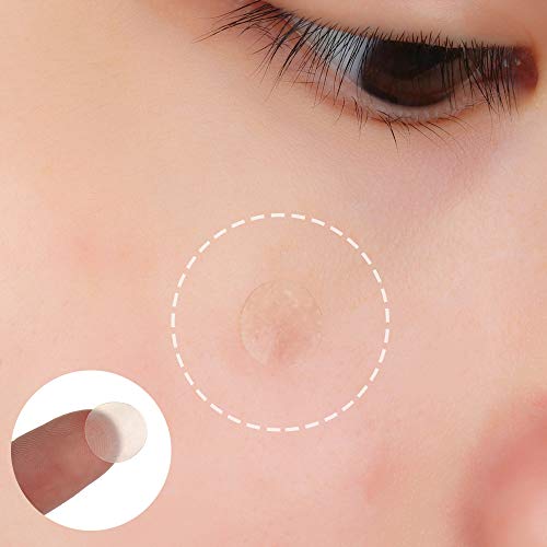 Parches Acne,ROBERT 216 pcs Parches Granos, Acné Hidrocoloide para Tratamiento de Espinilla, 3 size.