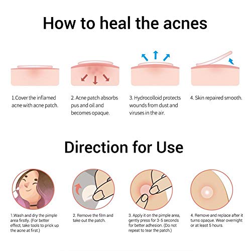 Parches Acne,ROBERT 216 pcs Parches Granos, Acné Hidrocoloide para Tratamiento de Espinilla, 3 size.