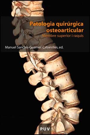 Patologia quirúrgica osteoarticular: Membre superior i raquis: 105 (Educació. Sèrie Materials)