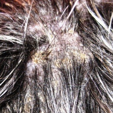 Peticare Perro Tratamiento Eficaz - 100% Biológico contra Picor, Hongos y Anti-Ácaros en Perros, Demódex, Ácaros de la Sarna y Otras Especies, Detiene Picazon Fuerte - petDog Protect 2101