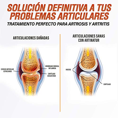 Potente Cúrcuma + Condroitina + Glucosamina + Bioperina Pura | Elimina dolores en músculos, articulaciones y huesos | Antiinflamatoria Natural con acción analgésica y regeneradora | 90 Caps.