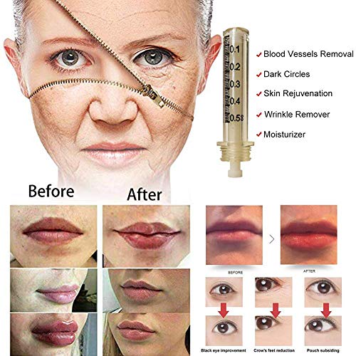 QIYE 15 Pcs Reemplazo Hyaluron Acid Pen Accesorios, 0.5 ML Consumibles Desechables Ampollas Estériles Suministros De Belleza, Deep Replenishment and Rich Nourishment, No Contiene líquido