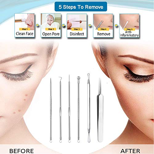 Removedor de espinillas de acero inoxidable, aguja para apretar la cutícula higiénica y segura pinza para espinillas con aguja para el acné, un conjunto de 6 herramientas