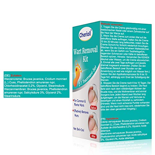 Removedor de verrugas, Eliminar Verrugas, Eliminar Durezas Y Callos, Tratamiento de verrugas Líquido eliminador de verrugas, Kit Para Eliminar Verrugas