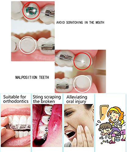 RZJZGZ - Cera de ortodoncia para el cuidado dental con olor a fruta, para los usuarios de ortodoncia, protección de encías saborizada