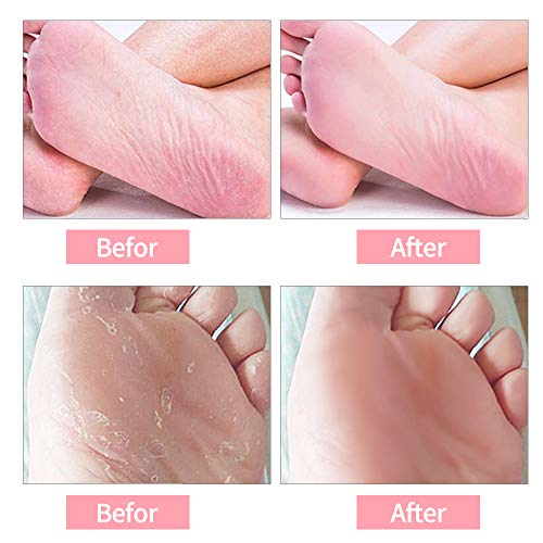 Scholl, 12 rodillos de repuesto para pedicura Scholl, para pedicura dura Scholl, Scholl Velvet Smooth, Scholl Foot Lime, Pedicura Hard Skin Remover, Limas de pies para piel dura (4 colores)