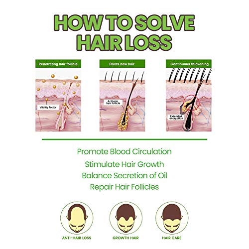 Serum de Crece Pelo con Esencia de Jengibre 60ML, Promueve el crecimiento del cabello al nutrir el Folículo Piloso, Anticaida de Cabello para Hombre y Mujer