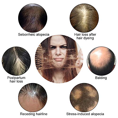 Serum Pelo,Hair Serum,Serum Cabello,Hair Growth Serum,Crecimiento Cabello Serum,Anti Pérdida de Cabello,Promueve el Crecimiento Del Cabello,el Suero para el Cabello Fortalece Las Raíces Del Cabello