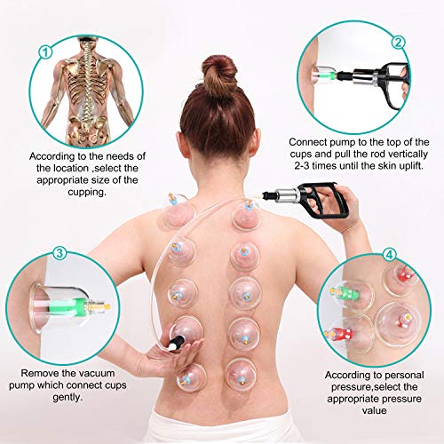 Set de ventosas de alta calidad médicas con imán terapéutico, 12 vasos con bomba de vacío y válvula, auto-tratamiento masajeador para dolor de espalda, celulitis, cara, adelgazamiento, abdomen