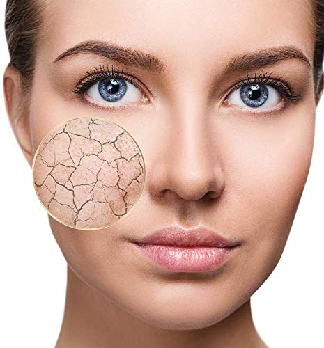 Simon & Tom PRO SKIN - HYDRATATION SERUM FACIAL - Regulador y Reparador, Previene el Acné y el exceso de grasa, con Aceite Natural de Árbol de Té, Acabado mate, Anti-inflamatorio, 30ml