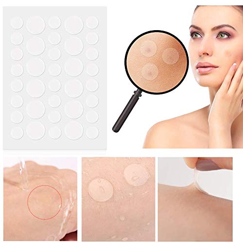 Skin Tag Remover Patch，Mole Removal Patches，Parche Para Acné y Granos，Cubra y OLculte Etiquetas de piel, Parches de Tratamiento de Etiquetas de Piel