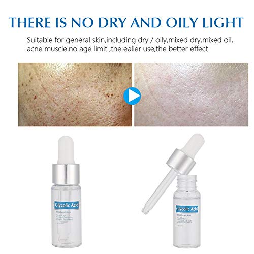 Solución de ácido glicólico, Dekaim Solución de ácido glicólico al 30% Eliminación de espinillas Blanqueamiento Cara Cuidado de la piel Líquido 15 ml