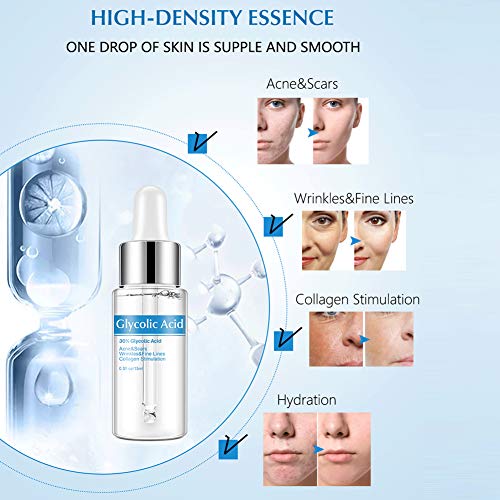 Solución de ácido glicólico, Dekaim Solución de ácido glicólico al 30% Eliminación de espinillas Blanqueamiento Cara Cuidado de la piel Líquido 15 ml