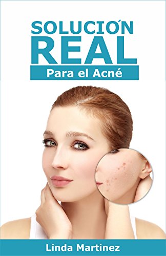 Solución Real para el Acné: Eliminar el acné es posible