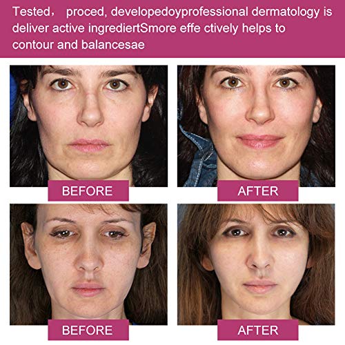 Suero facial, Suero Antienvejecimiento, Suero facial en V, Contorno de la barbilla, Suero Antiarrugas, línea en V de elevación de mentón doble, tratamiento reafirmante para rostro y cuello.