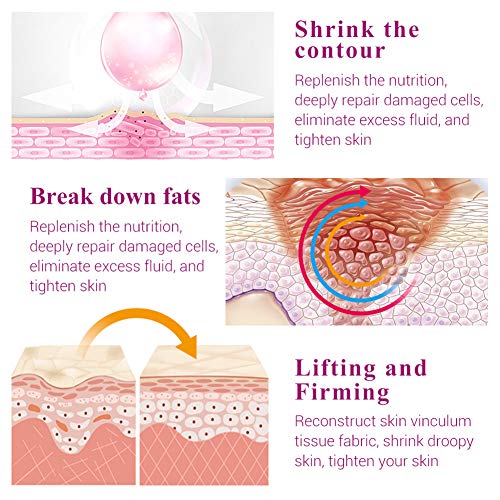 Suero facial, Suero Antienvejecimiento, Suero facial en V, Contorno de la barbilla, Suero Antiarrugas, línea en V de elevación de mentón doble, tratamiento reafirmante para rostro y cuello.