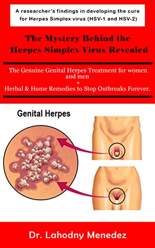 The Mystery Behind the  Herpes Simplex Virus Revealed: The Genuine Genital Herpes Treatment for women and men  + Herbal & Home Remedies to Stop Outbreaks Forever. (English Edition)