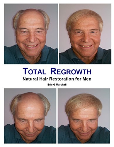 Total Regrowth: Natural Hair Restoration for Men (English Edition)