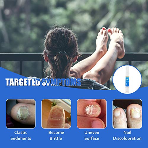 Tratamiento de hongos anti hongos, Tratamiento de hongos anti hongos, Tratamiento de uñas anti hongos líquido para el cuidado de las uñas adecuado para uñas de dedos y pies