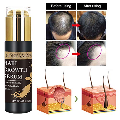 Tratamiento para el Cabello,Sérum de crecimiento del cabello,Hair Growth Serum,Sérum de Crecimiento del Cabello,promueve más cabello ticker, más completo y más rápido crecimiento