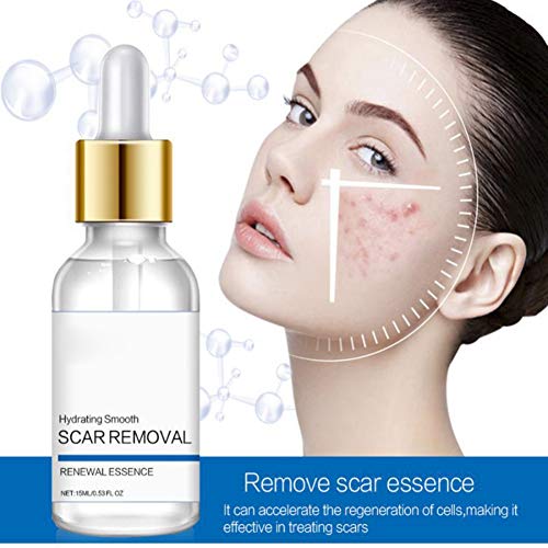Tratamiento para la eliminación de cicatrices de acné para la cara, quitar y aclarar cicatrices, puntos y marcas, natural, marcas de cicatrices líquidas reparadoras