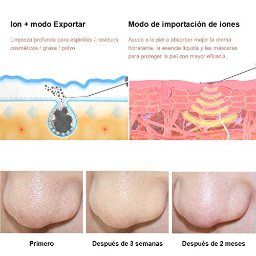 Ultrasonic Skin Scrubber Ultrasónico Piel Limpieza Facial Skin Scrubber Wolady 4 in 1 USB Carga Ultrasonic Peeling Piel Masajeador Facial Extractor Blackhead Remover Poro Exfoliación Comedón Acné Piel