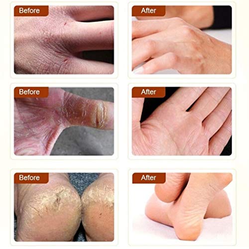 WARMWORD Crema para pies, el Cuidado de los pies reparadora Manos contra Las Grietas y Anti deshidratación eliminación Piel Muerta reparación Aceite plátano Anti-Agrietado Anti-Secado eliminador
