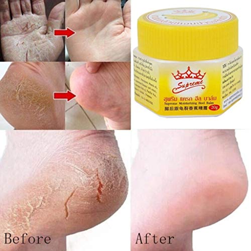 WARMWORD Crema para pies, el Cuidado de los pies reparadora Manos contra Las Grietas y Anti deshidratación eliminación Piel Muerta reparación Aceite plátano Anti-Agrietado Anti-Secado eliminador